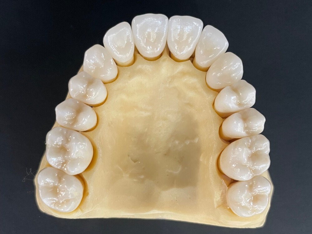 Digital Teeth Model