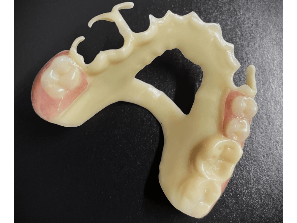 Digital Teeth Model