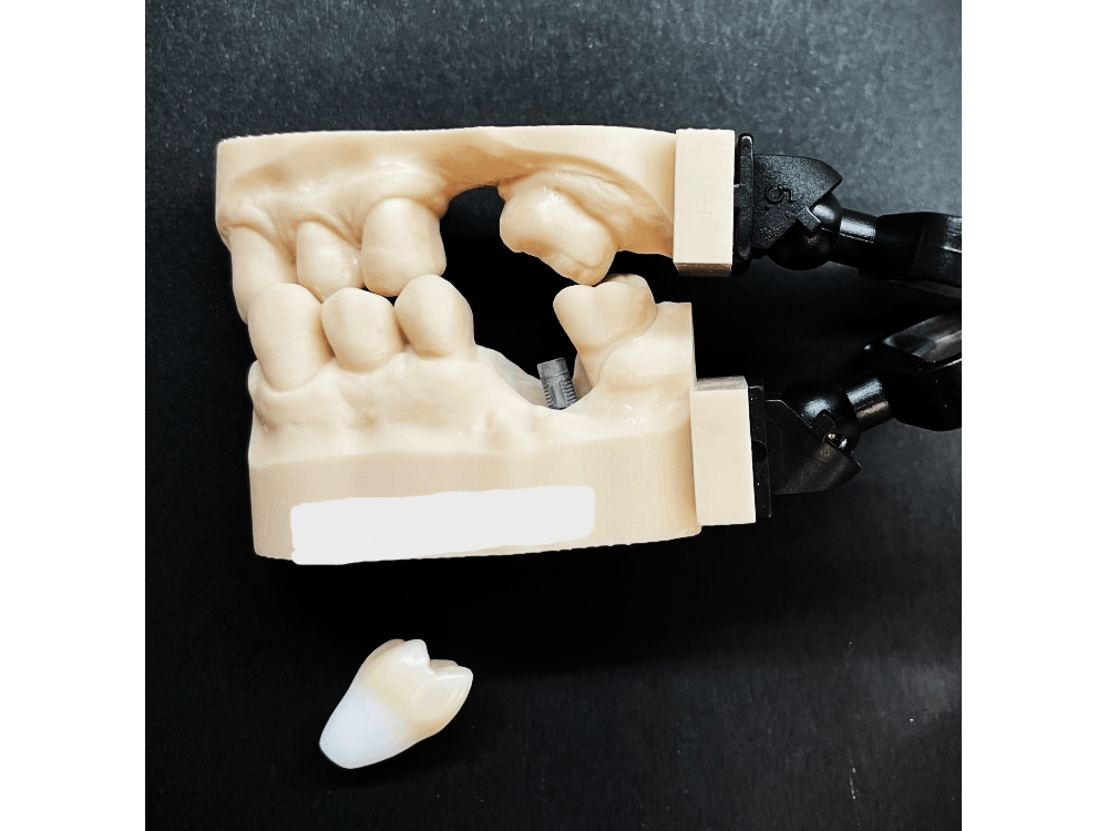 Digital Teeth Model