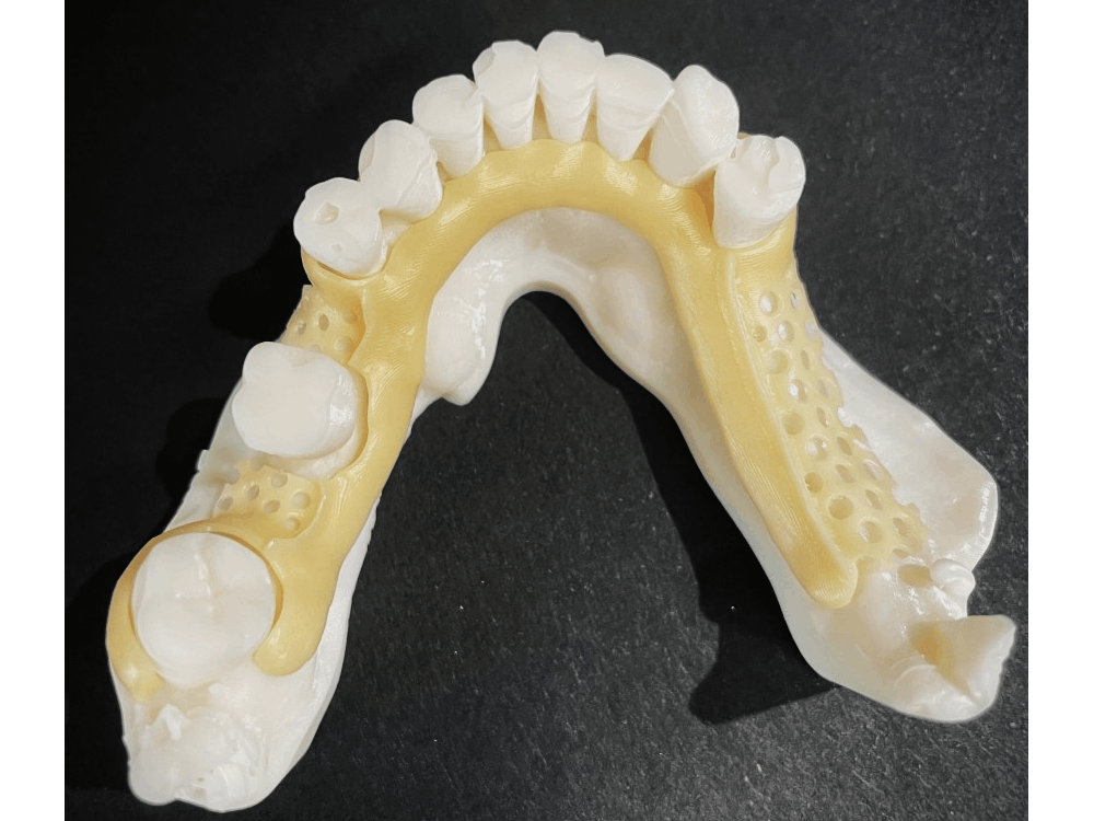 Digital Teeth Model