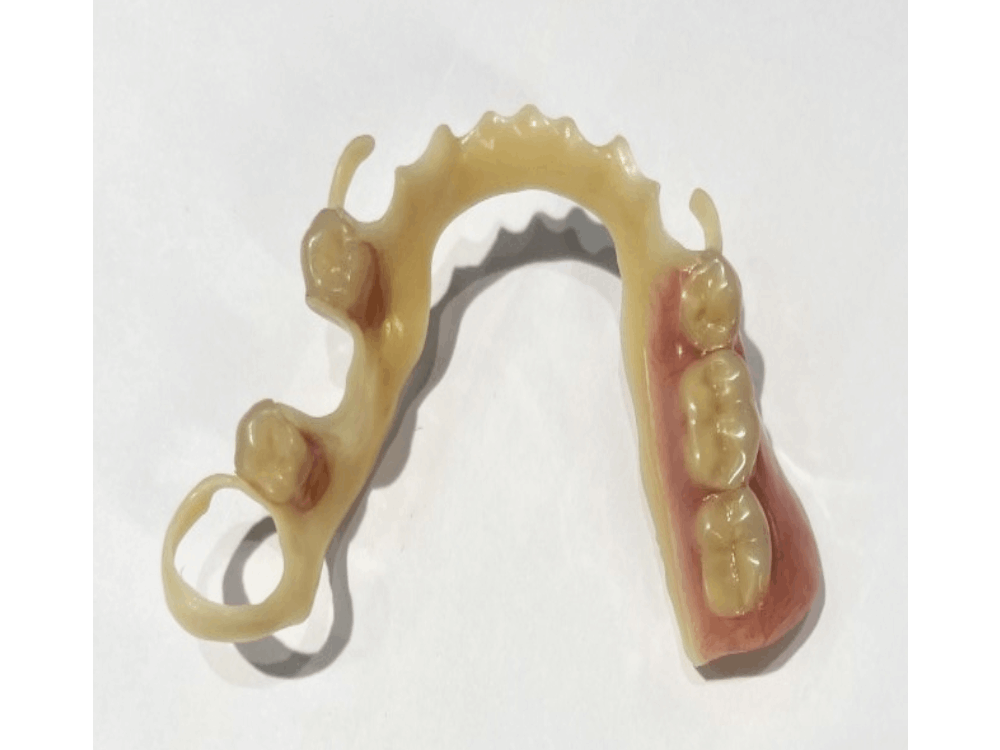 Digital Teeth Model