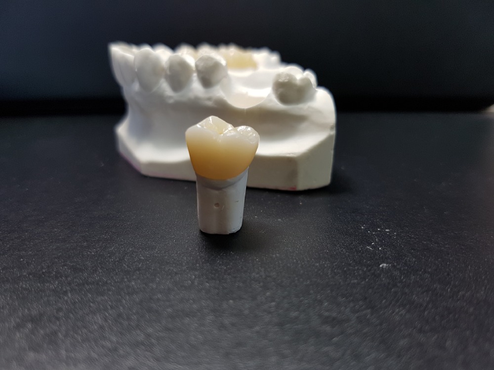 Digital Teeth Model