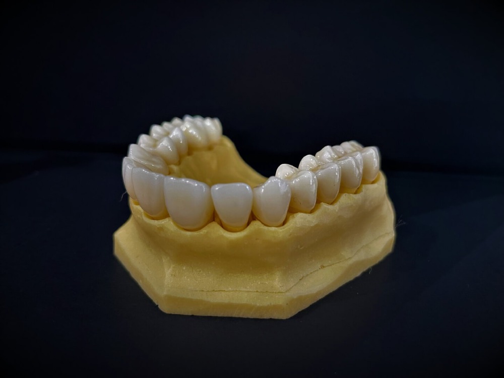 Digital Teeth Model