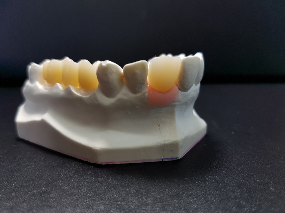 Digital Teeth Model