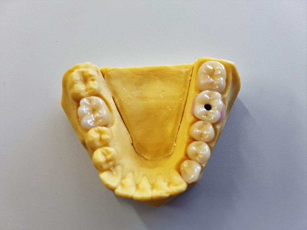 Digital Teeth Model